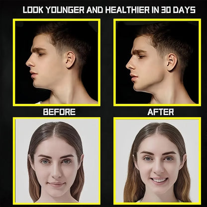 “Flexoora Jaw Trainer – Gym Fitness Body Silicone Face Chew, 3 Resistance Levels”