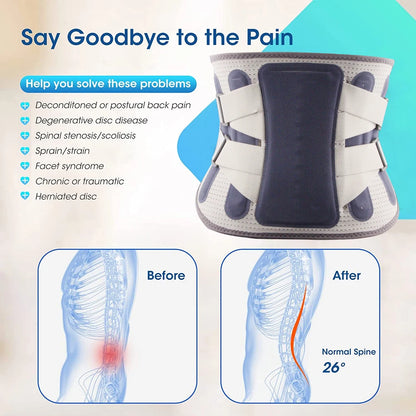 “Flexoora Lumbar Support Back Brace – Gym Fitness Body Adjustable Belt with Bionic Support Plate for Lower Back & Sciatica”
